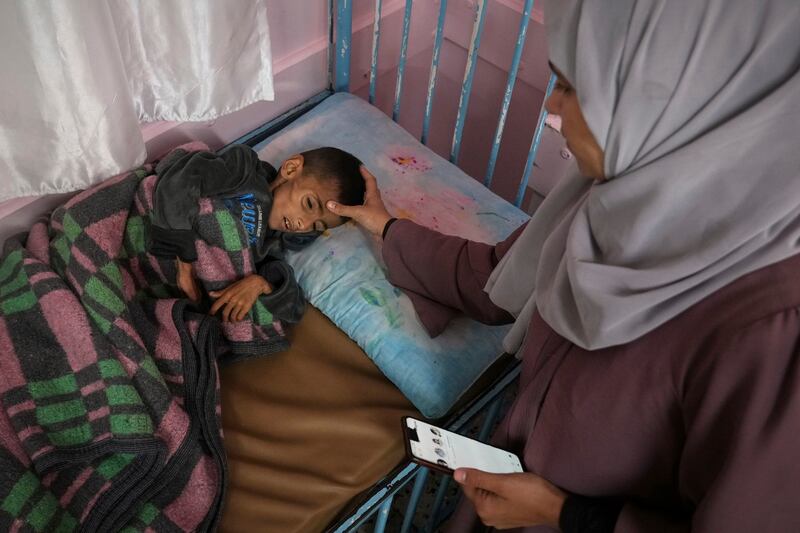 Mona al-Raqab cares for her son Osama (5). She says his cystic fibrosis has worsened since the start of the war due to the lack of meat, fish and enzyme tablets to help him digest food. Photograph: Abdel Kareem Hana/AP