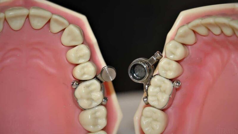 The device uses magnetic components with locking bolts.