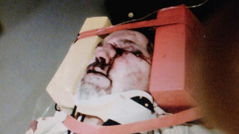 Noel Hill on the night of his assault on St Stephen’s Day, 2008