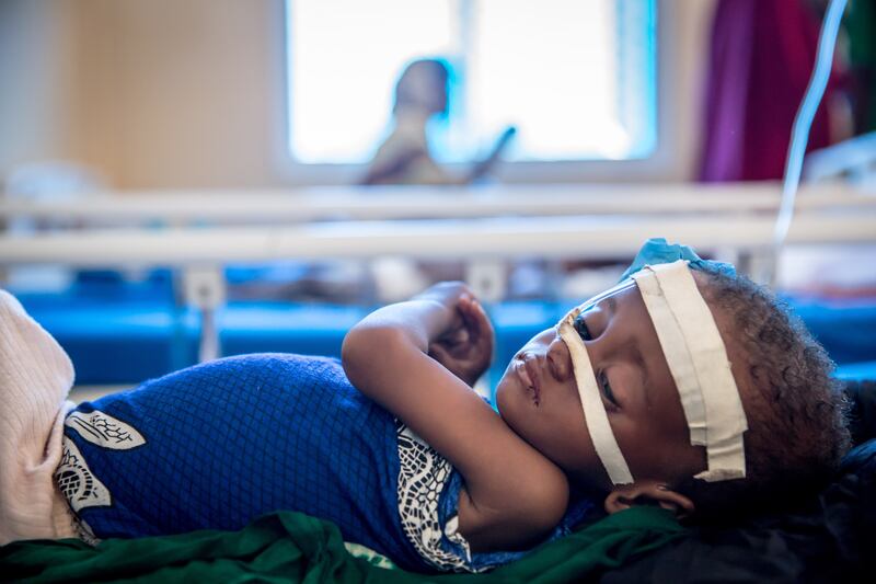Abdirahman, 11 months old, was taken to Banadir Hospital by his mother and aunt, who say the drought in Somalia means their family has struggled to get enough to eat. Photograph:  Sally Hayden.