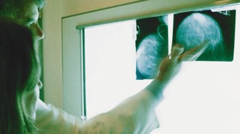 Over three in every four cases diagnosed in emergency departments are at an advanced stage, according to an Irish Cancer Society study. File photograph: Getty Images