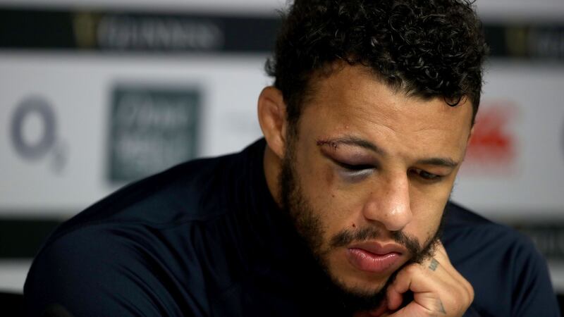 Courtney Lawes with a black eye ahead of England’s clash with Ireland on Sunday. Photograph: Dan Sheridan/Inpho