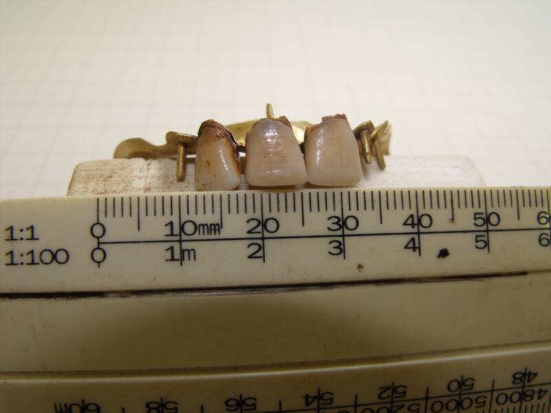 Waterloo teeth: the battlefields of slain soldiers were often pillaged for their teeth to be sold on for dentures