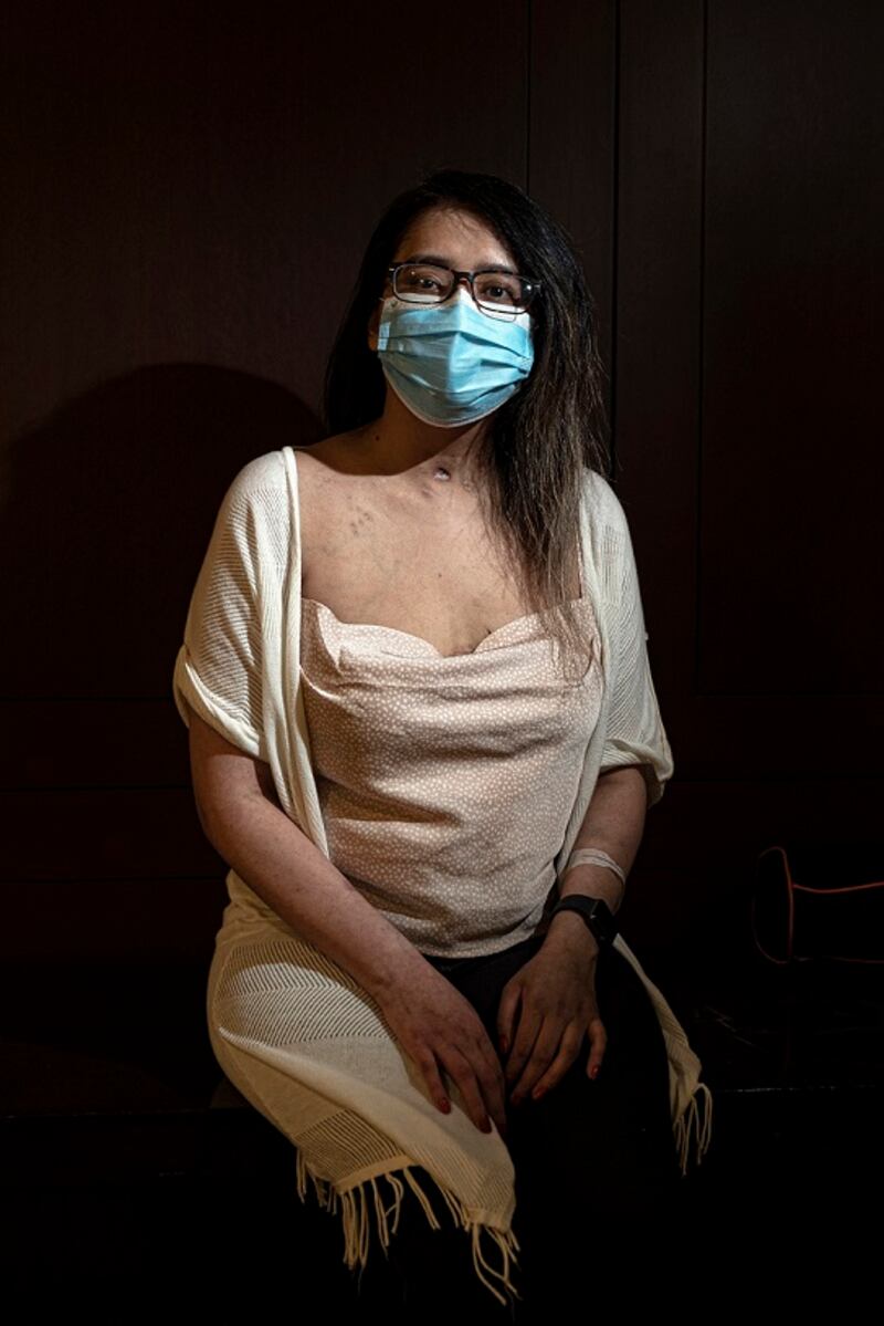 Mayra Ramirez of Chicago, recipient of the first double-lung transplant. “I want you to show the scars,” she said.