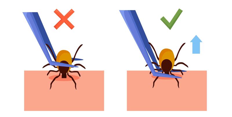 Use fine tweezers to remove a tick, grabbing it really close to the skin