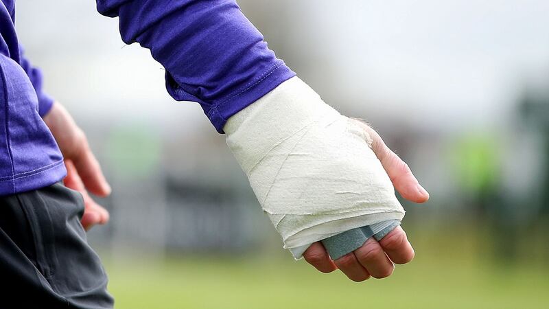 Richard Keogh’s broken hand during  training with Ireland at the FAI National Training Centre. Photograph:  Bryan Keane/Inpho
