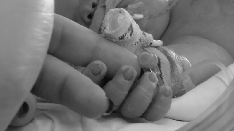 Archie in the incubator, shortly after he was born.