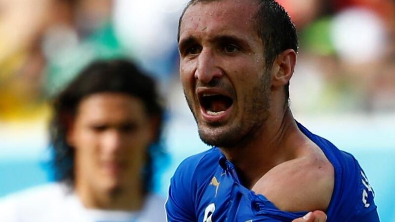 Italy’s Giorgio Chiellini shows his shoulder, claiming he was bitten by Uruguay’s Luis Suarez,   at the Dunas arena in Natal. Photograph: Tony Gentile / Reuters