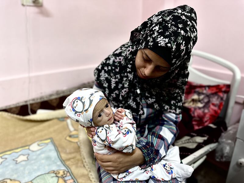 KHAN YUNIS, GAZA - MAY 1: 5-month-old Suwar Ashur, one of hundreds of children diagnosed with malnutrition, is being treated at Nasser Hospital in Khan Yunis, Gaza on May 1, 2025. Children are struggling with malnutrition in Gaza, where there is a food crisis due to the ongoing Israeli air and ground attacks and closed borders. (Photo by Doaa Albaz/Anadolu via Getty Images)