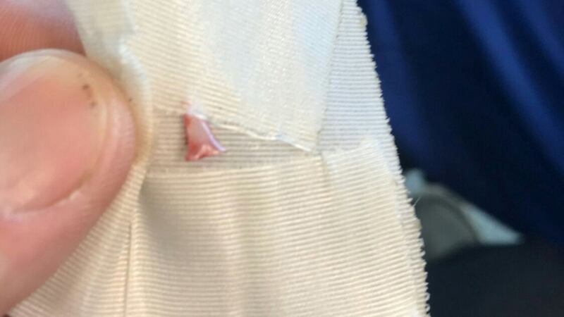 A suspected shark’s tooth extracted from the leg of a 13-year old boy, who was attacked at Atlantique Beach in Islip, New York. Photograph courtesy of Jason Hager/Ocean Beach Fire Department/Reuters