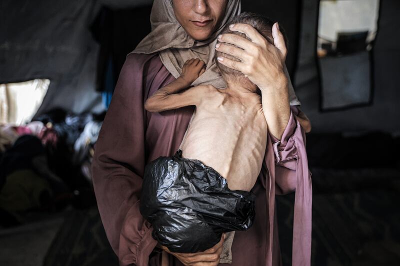 Muhammad Zakariya Ayyoub al-Matouq, a one-and-a-half-year-old child, in Gaza city this week. Photograph: Ahmed Jihad Ibrahim Al-arini/Anadolu/Getty