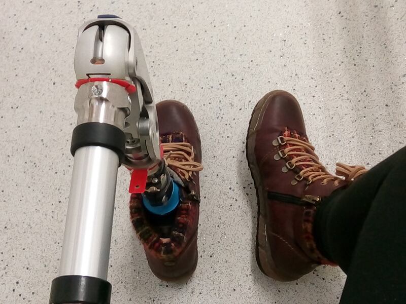 Tanya’s prosthetic ‘tends to fall forward and uses a lot of energy on my part’