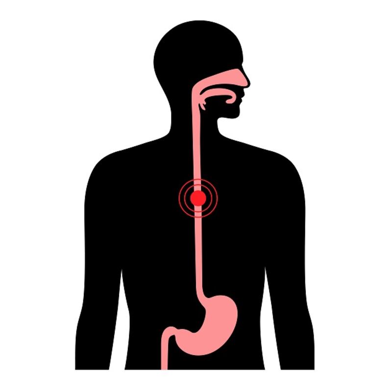Irish Oesophageal Cancer rates remain among the highest in Europe, with approximately 450-500 new diagnoses of this aggressive cancer each year.