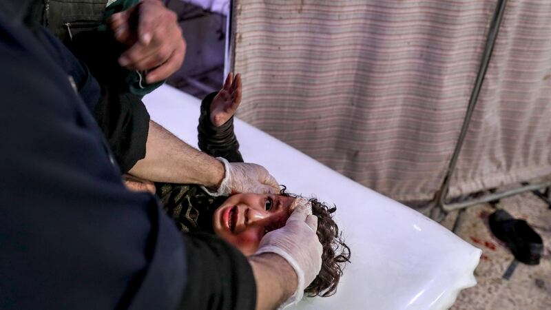 An injured child receives treatment following bombings on several areas of eastern Ghouta, at a hospital in Douma, Syria. Photograph: Mohammed Badra/EPA