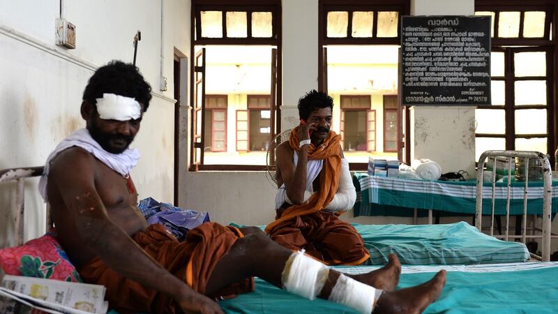 A victim recovers at a Kollam district hospital after a fire triggered by fireworks resulted in an explosion and a roof collapse at a temple in Kollam, India, on Sunday. Photograph: EPA
