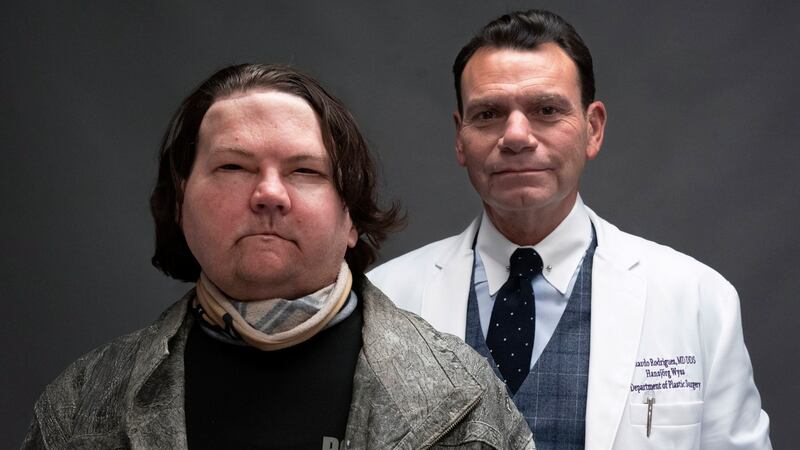 Joe DiMeo and his plastic surgeon Dr Eduardo Rodriguez pose for a portrait in January in New York. Photograph: Mark Lennihan/AP