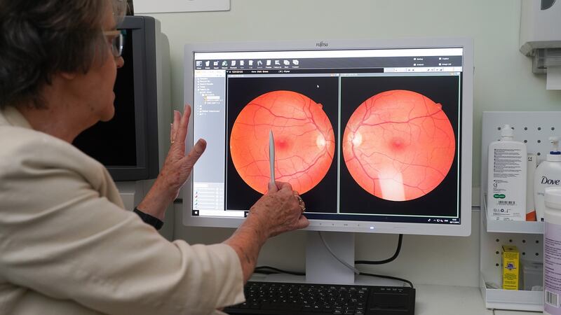 Looking at the eye more closely. Photograph: Conor Mulhern