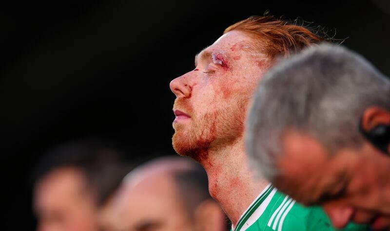 Limerick's Cian Lynch after the game. Photograph: James Crombie/Inpho