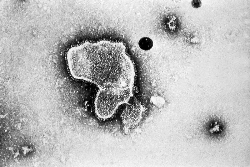 An undated photo provided by the US Centers for Disease Control and Prevention of a transmission electron microscopic image of RSV. Photograph: CCDC via The New York Times 
                      