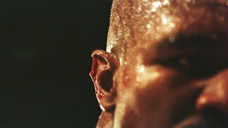 Evander Holyfield’s ear after he was bitten by Mike Tyson during their WBA heavyweight bout in Las Vegas in 1997. Photograph: Inpho/Allsport