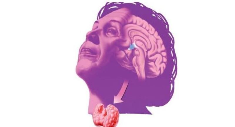 When the thyroid gland malfunctions, it either produces too much thyroid hormone leading to hyperthyroidism or too little thyroid hormone, leading to hypothyroidism