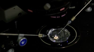 In this October 9th, 2018 photo, an embryo receives a small dose of Cas9 protein and PCSK9 sgRNA in a sperm injection microscope in a laboratory in Shenzhen in southern China’s Guangdong province.