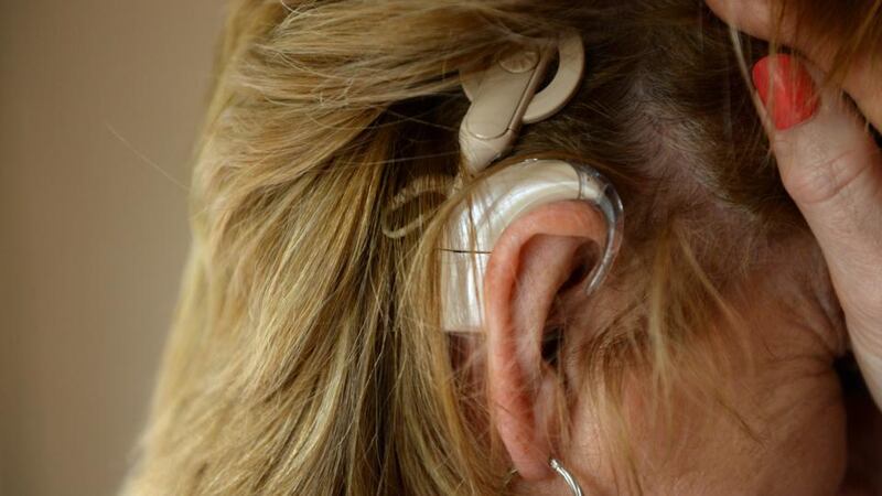 Maria Mezzetti’s cochlear implants. Photographs: Dara Mac Dónaill