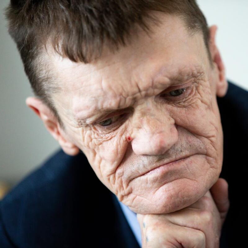 Paddy Fay: ‘How did I survie out there for so long?’ Photograph: Tom Honan/The Irish Times