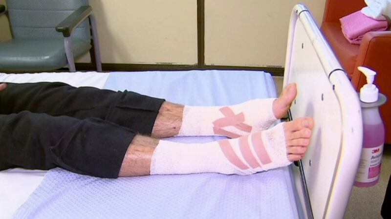 Sam Kanizay’s legs of are seen on a bed of a hospital where he is being treated in Melbourne. Photograph: Australia Pool via AP