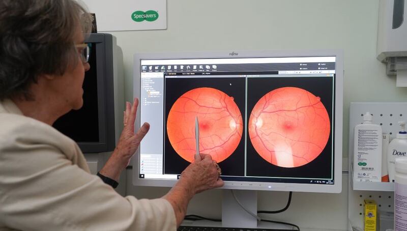 Looking at the eye more closely. Photograph: Conor Mulhern